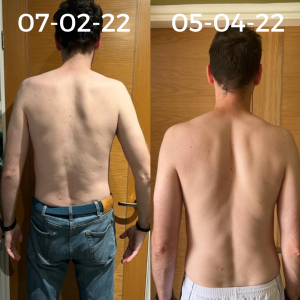 Stewart Before and After